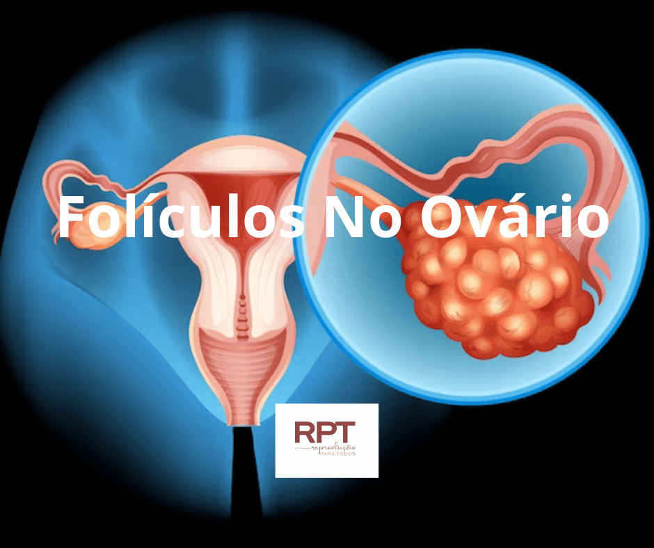 Folículos No Ovário