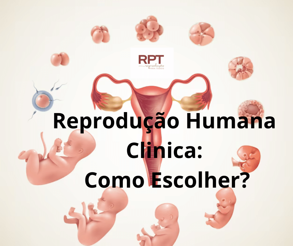 Reprodução Humana Clinica, Como Escolher?