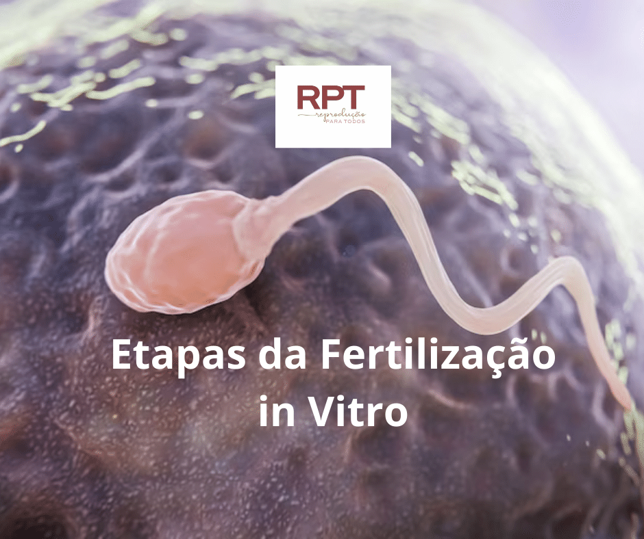 Etapas da Fertilização in Vitro